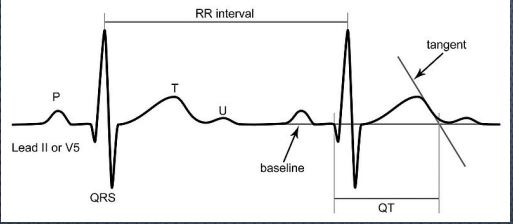 RR-intervals1