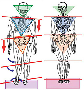 body alignment