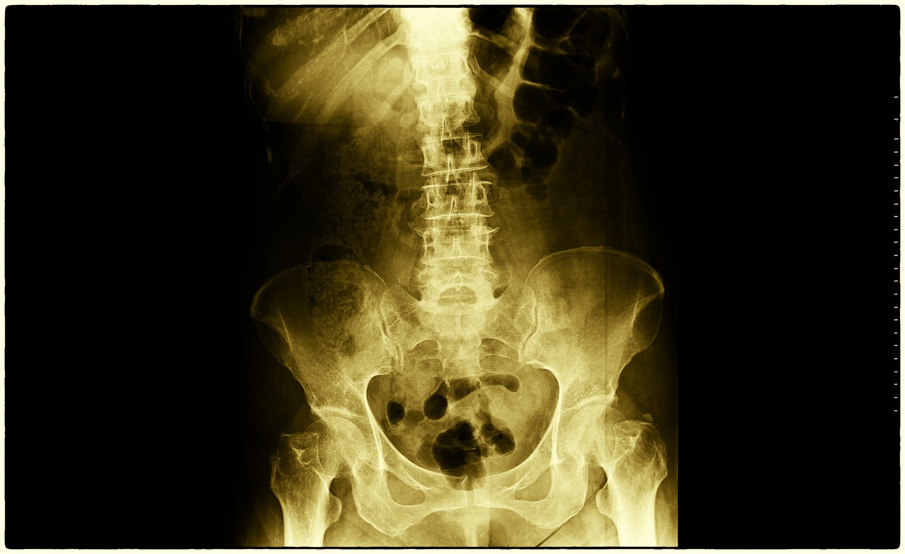 golden x ray scan of pelvis and spine 2026
