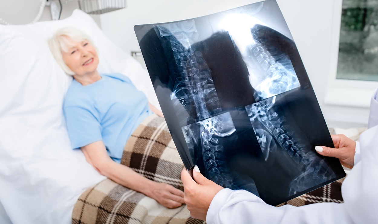 senior woman looking at x ray in hospital bed 2026