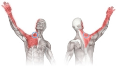 neck arm pain