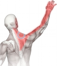 neck tennis elbow pain pattern