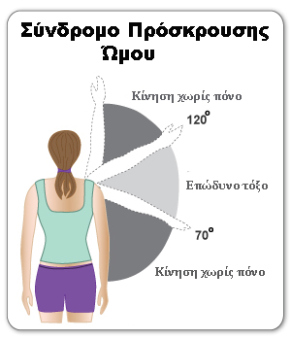 shoulder-impingement-syndrome-painful-arc