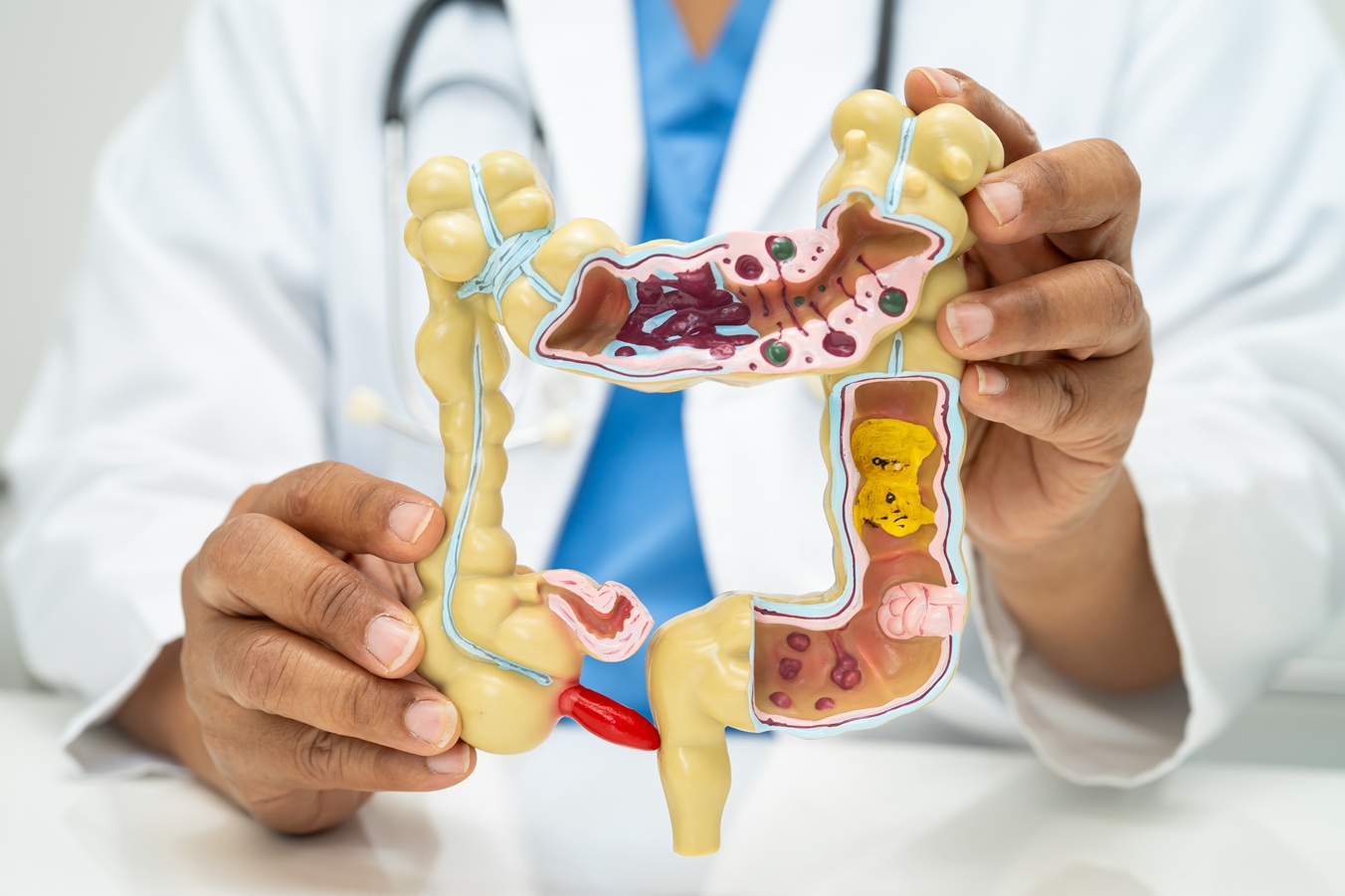 intestine appendix and digestive system doctor