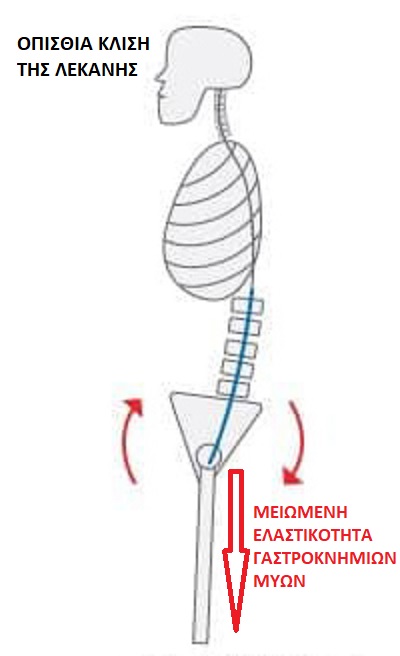 posterior-pelvic-tilt-12