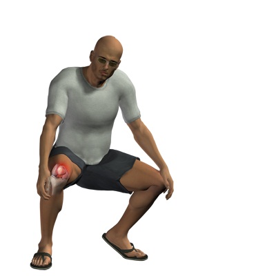 knee chondromalacia