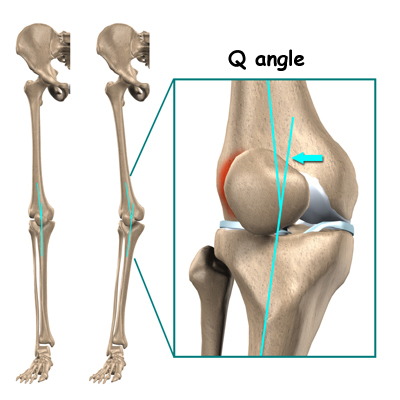 patella Qangle