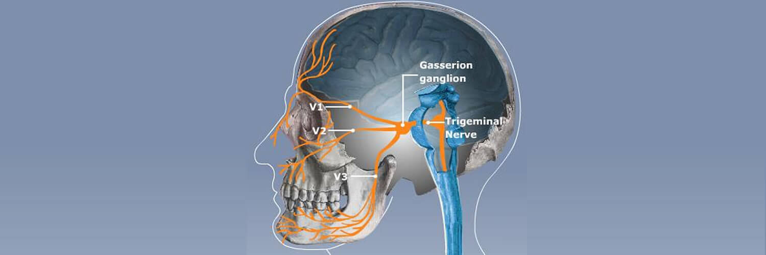 trigeminal-neuralgia-disease